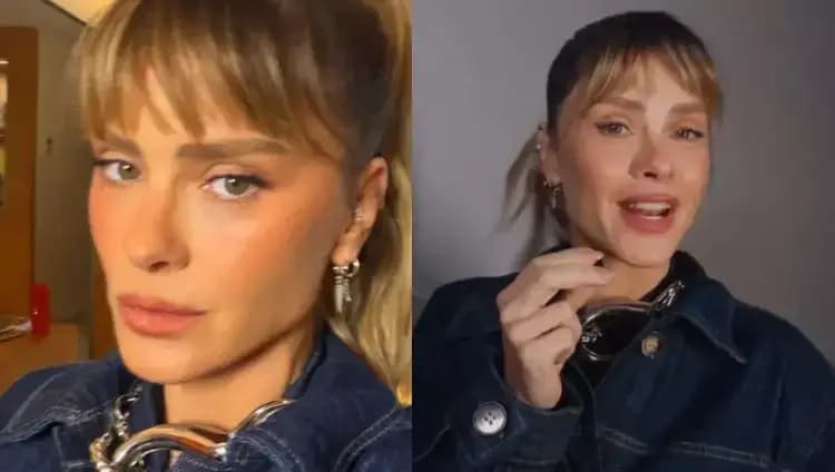 Carolina Dieckmmann surge com rosto renovado após procedimento de R$ 28 mil