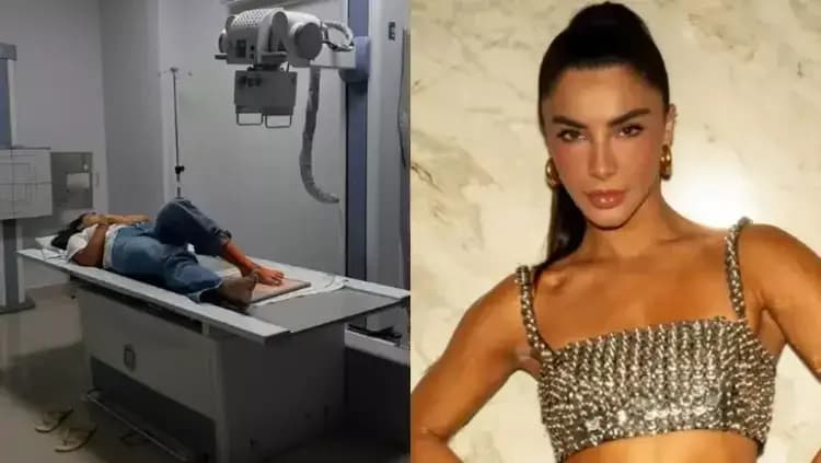 Gabriela Versiani sofre acidente doméstico e afirma: 'Quebrou mesmo'