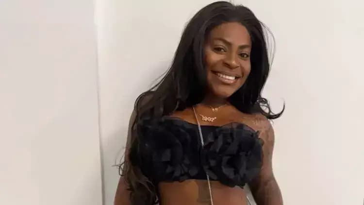Após perder 90 kg, Jojo Todynho passa por nova cirurgia estética