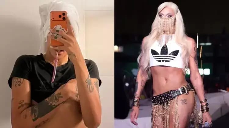 Pabllo Vittar passa por terceira rinoplastia e resultado chama atenção