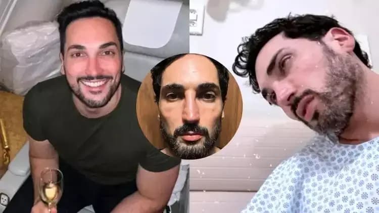 Famoso fica com o rosto 'derretido' após usar Mounjaro e faz alerta