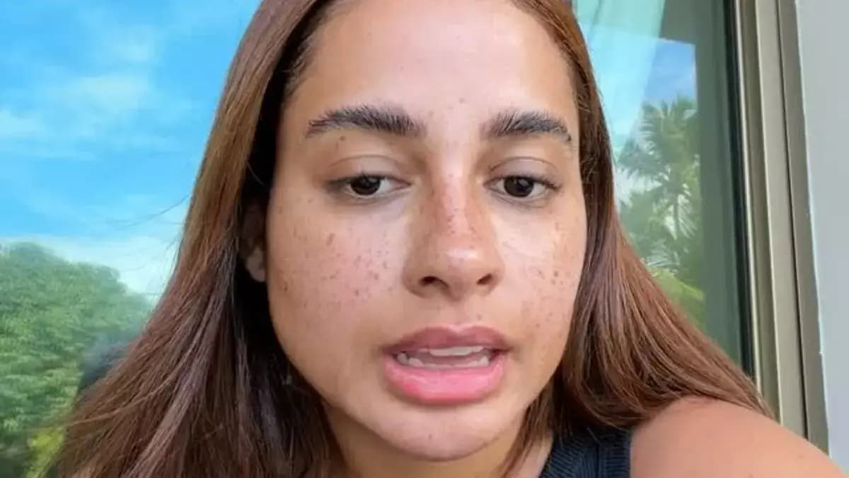 Veja o antes e depois de MC Lomma e saiba quais procedimentos ela já fez no rosto